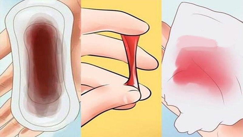 chảy máu vùng kín