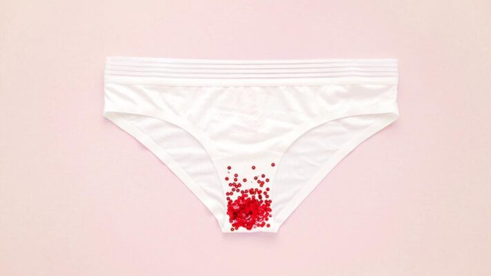 chay mau am dao bat thuong5