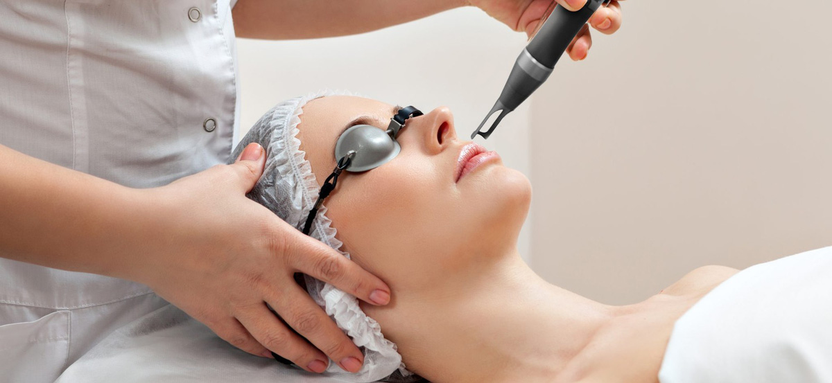 Sắc tố nữ: Thông tin, Nguyên nhân, Yếu tố ảnh hưởng và Cách cải thiện 5 Sử dụng Laser