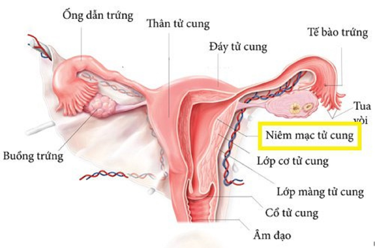 Nội Mạc Tử Cung Mỏng