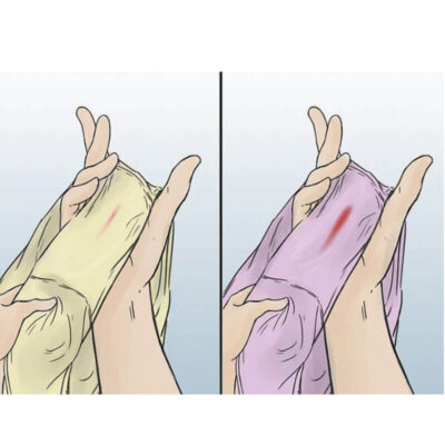 Quan hệ khi chưa sạch kinh