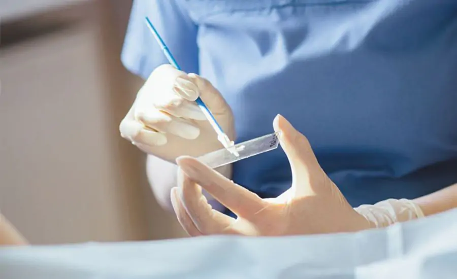 Vì sao ngứa vùng kín: Phân tích Nguyên nhân, Triệu chứng và Cách xử lý 5 soi tươi dịch âm đạo