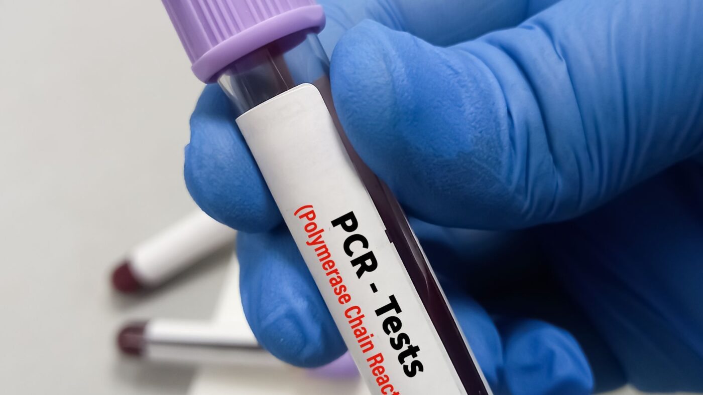 Xét nghiệm PCR