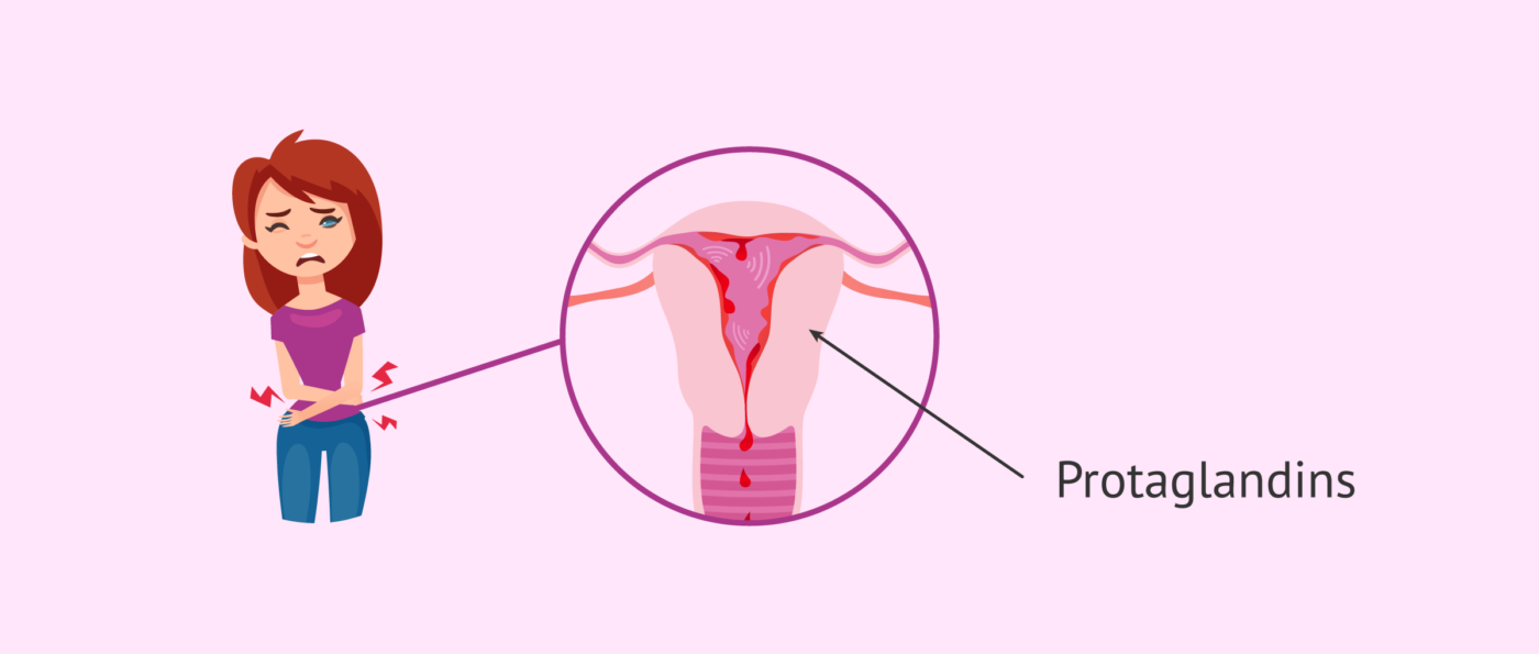 Primary Dysmenorrhea