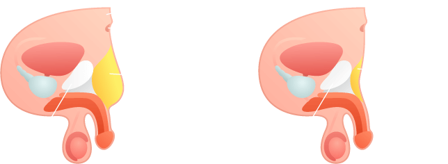 Pubic Fat Pad