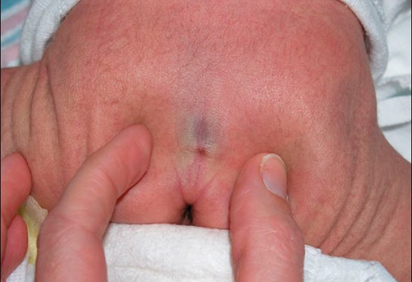 Hõm Venus: Thông tin, Nguyên nhân, Ý nghĩa và Cách sở hữu 7 Trẻ em có hõm VenuS