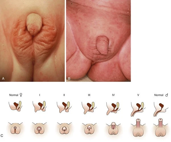 Biểu hiện rõ ràng khi sinh