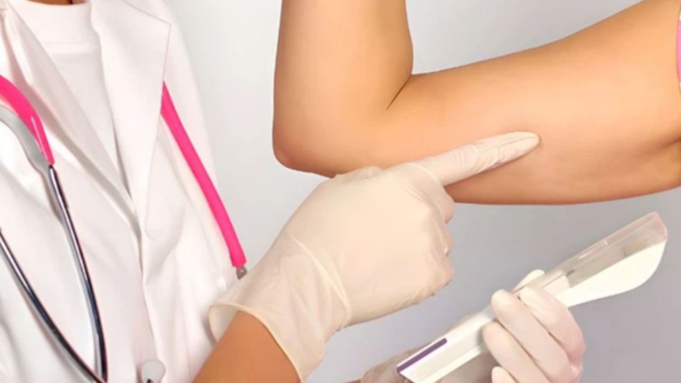 Chăm sóc sau khi cấy que