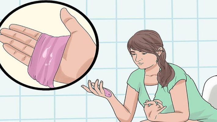 Hiện Tượng Sau Khi Đặt Thuốc