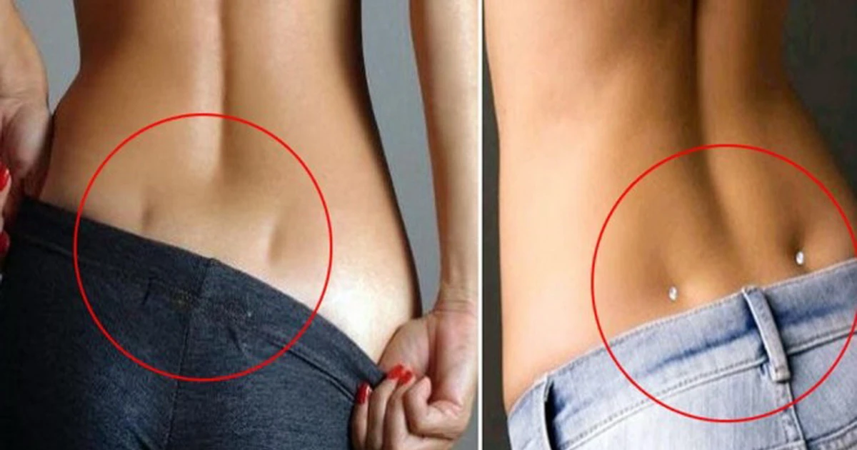 Hõm Venus: Thông tin, Nguyên nhân, Ý nghĩa và Cách sở hữu 1 Hõm Venus