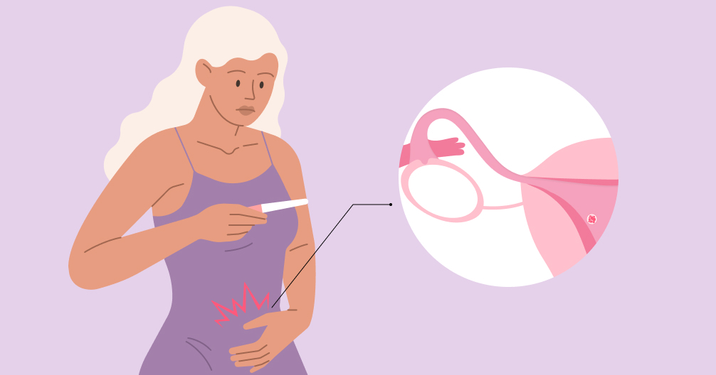 implantation cramping