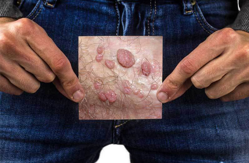 Gel bôi tăng kích thước: Thông tin, Cơ chế, Hiệu quả và Cách sử dụng 5 kích ứng da