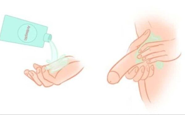 Vệ sinh cậu nhỏ bằng nước muối