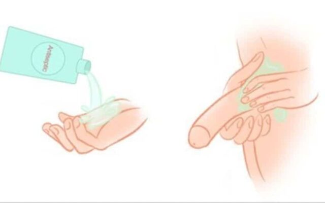 Vệ sinh cậu nhỏ bằng nước muối